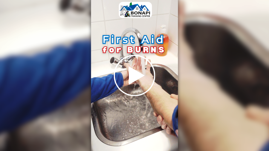 First aid for burns - reel gemaakt voor Bonapi